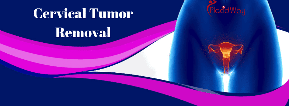 Cervical Tumor Removal